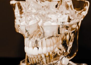 Tote Zähne verursachen systemische Beschwerden in der biologischen Zahnmedizin